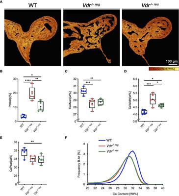 Prevention of Hypomineralization In Auditory Ossicles of Vitamin D Receptor (Vdr) Deficient Mice